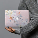 hardshell case with Paisley design combines a sleek hardshell design with vibrant colors for stylish protection against scratches, dents, and bumps for your Macbook